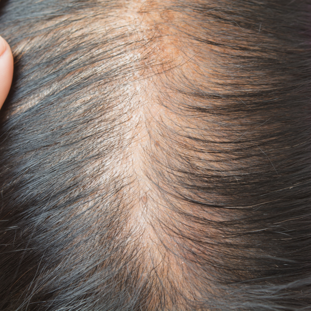 Why is my hair falling out? Lets get to the root of the cause! – Wintle ...